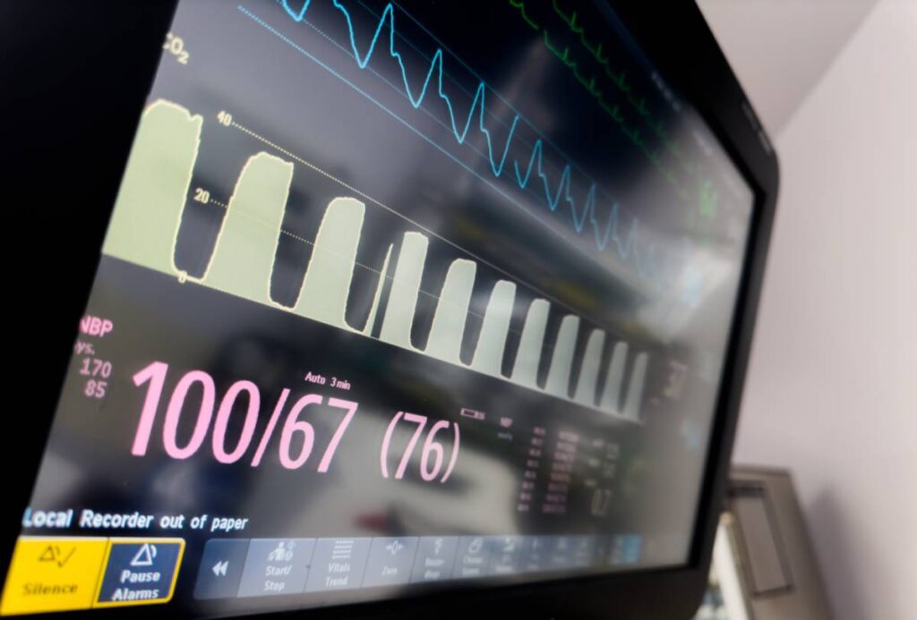 Minnesota Anesthesia Services